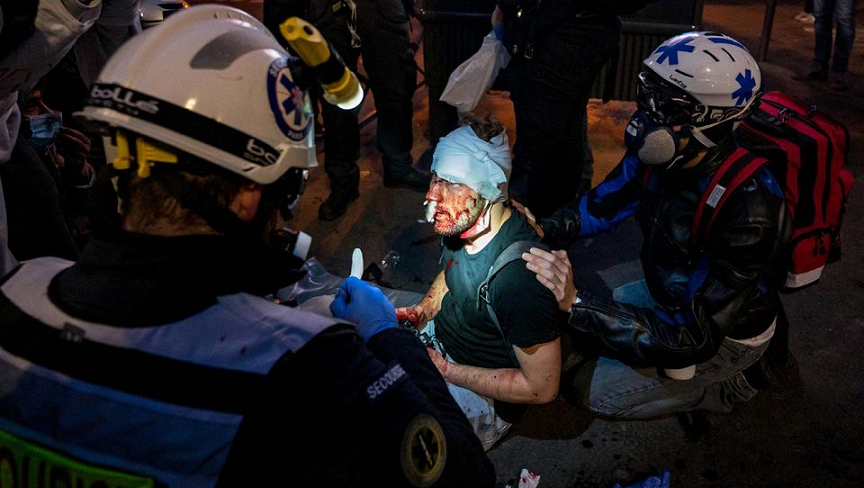 Francuska policija brutalno pretukla nagrađivanog fotoreportera iz Sirije – The Balkantimes Press