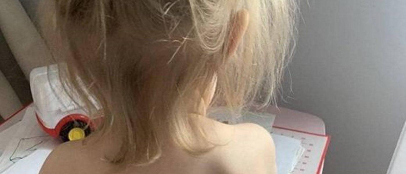 Zašto su djeca iz Ukrajine "tetovirana" na leđima?
