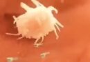 VIDEO: Immune cell chases bacteria and eliminates them